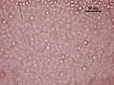 10 - Cellule stellate nella zona subcorticale
